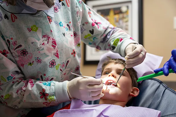 Cracked Tooth or Severe Pain? Why Extraction May Be the Last Choice